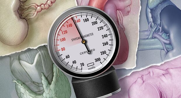 A hipertensión caracterízase por valores de presión arterial sistólica por encima dos 140 mmHg