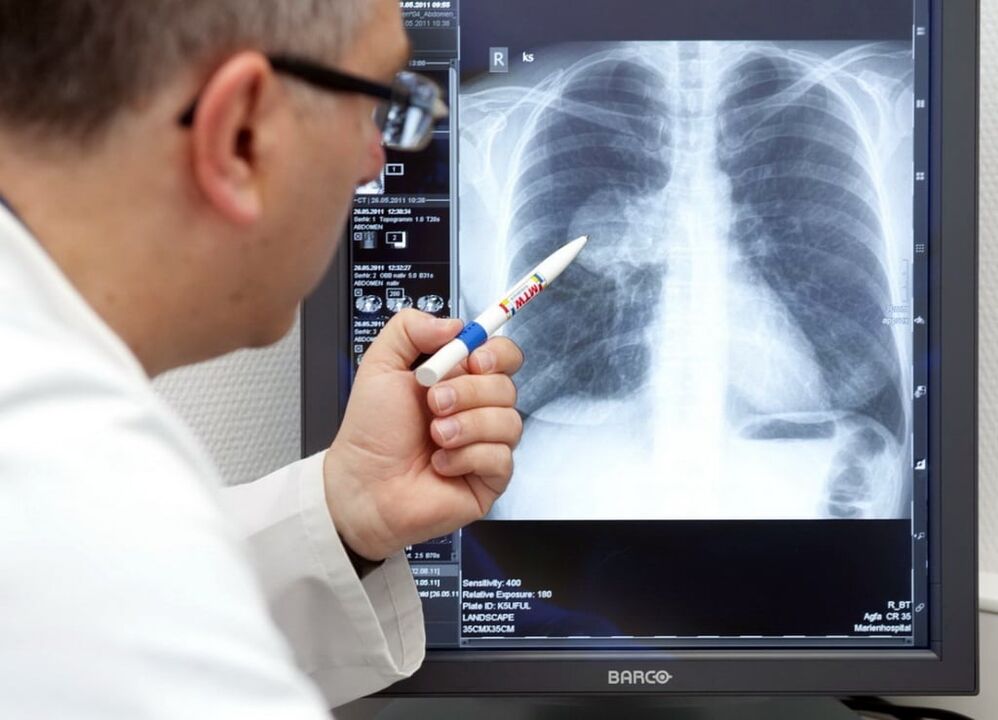Diagnóstico da hipertensión arterial